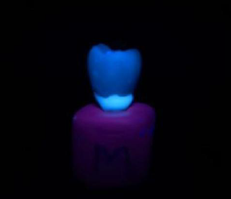 Carbon Quantum Dot-Tagged Dental Cement